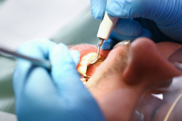Best Weekend Emergency Dentist in Syosset, NY