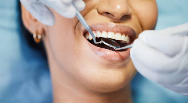 Best Broken or Cracked Tooth Emergency Dentist in Syosset, NY